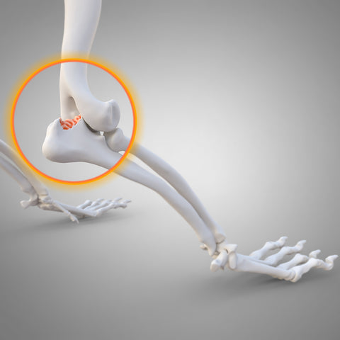 Ellbogendysplasie (ED)