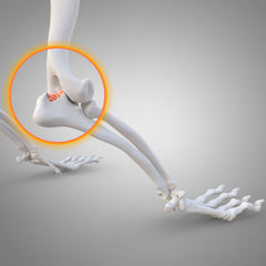 Ellbogendysplasie (ED)